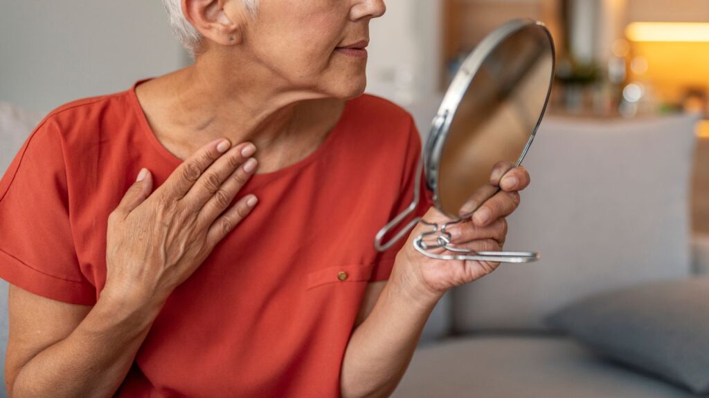 Collagen supplements